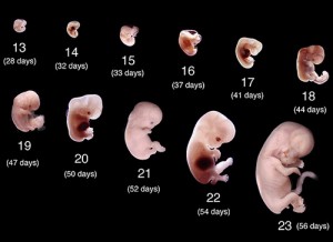 aborto gestacion